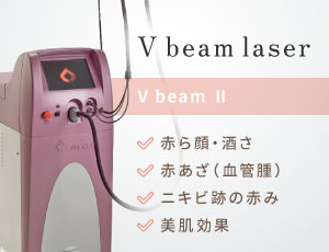 Vビームレーザー